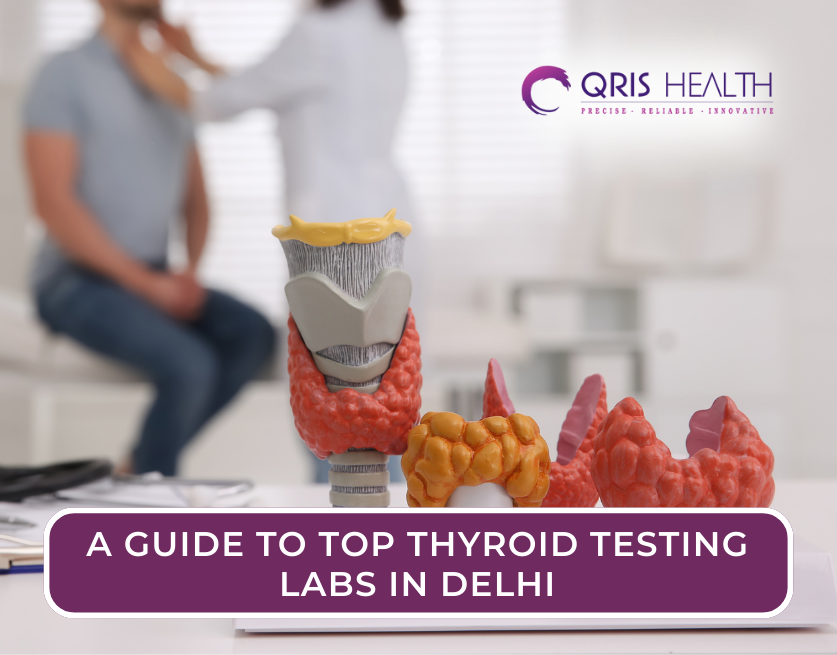 Thyroid Testing in Delhi